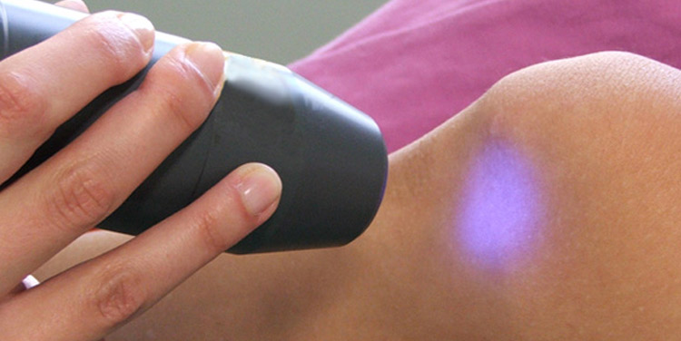 laser terapia